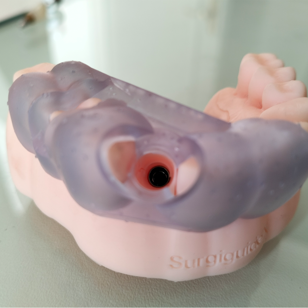 Tooth-supported guide